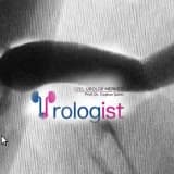 ÜRETRA DARLIĞI AMELİYATININ ÖNEMİ