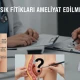 TÜM KASIK FITIKLARI AMELİYAT EDİLMELİ Mİ?
