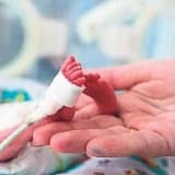 Prematürelere düzenli göz muayenesi şart