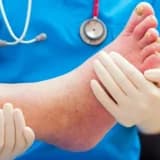 DİYABETİK AYAK BAKIMI