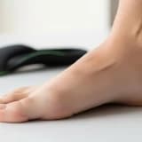 Erişkin Düz Tabanlık (Pes Planus) Nedir? Belirtileri ve Tedavi Yöntemleri