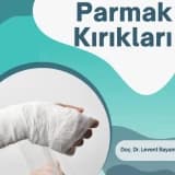 Parmak kırıkları