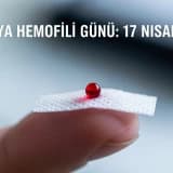 DÜNYA HEMOFİLİ GÜNÜ: 17 NİSAN