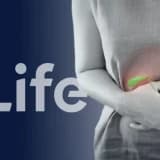 Safra Kesesi Ameliyatı (Kolesistektomi)