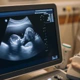 "Hamilelikte anomali taraması yaptırılmalı"