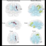İki Dil İle Büyümek Avantaj mı ? Yoksa Dezavantaj mı ?
