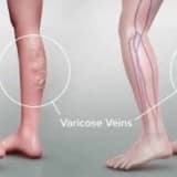 Varisin Yaptığımız İşle Ya Da Meslekle İlgisi Var Mıdır?