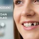 Gülüşünüzdeki Boşluk, Sandığınızdan Daha Fazlası