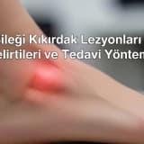 Ayak Bileği Kıkırdak Lezyonları Nedir? Belirtileri ve Tedavi Yöntemleri