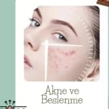 AKNE VE BESLENME