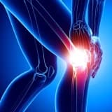 KONDROMALAZİ PATELLA (Diz kapağı kıkırdak yumuşaması) kimlerde görülür?