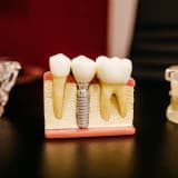 implant