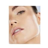 Çene Hattı (Jawline) Dolgusu