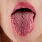 Ağız Kuruluğu Neden Olur?