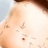 Estetik Cerrahide Doğru Olarak Bilinen 10 Yanlış