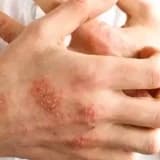 Stres Egzamaya Zemin Hazırlıyor!