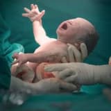 Doğum ve Sezaryen