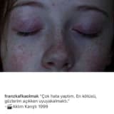 Depresyon Nedir?