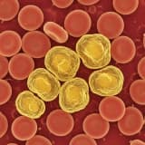 KAN YAĞLARI YÜKSEKLİĞİ İLE İLGİLİ YENİ BİLGİLER