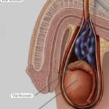 Varikosel ve Cinsellik İlişkisi