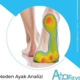 Neden Ayak Analizi Yaptırmalısınız?