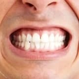 🌙 Diş Sıkma ve Gıcırdatma (Bruksizm)