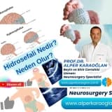 HİDROSEFALİ’nın Başlıca İki Türü ve Nedeni / Kommunike (İletişimli) ve Non-Kommunike Hidrosefali