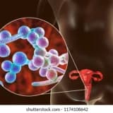 Vajinal Akıntı Nedir? Vajinada Kahverengi Akıntı Neden Oluşur?