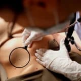 Kunduracı Göğsü Nedir? Nasıl Tedavi Edilir?