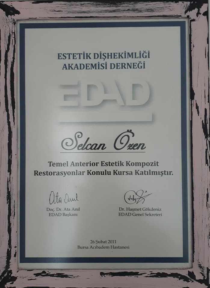 Estetik Kompozit Restorasyonlar