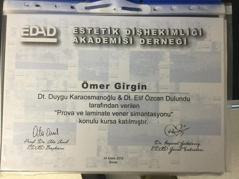 Prova Ve Laminate Vener Simantasyonu