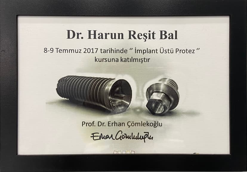 İMPLANT ÜSTÜ PROTEZ