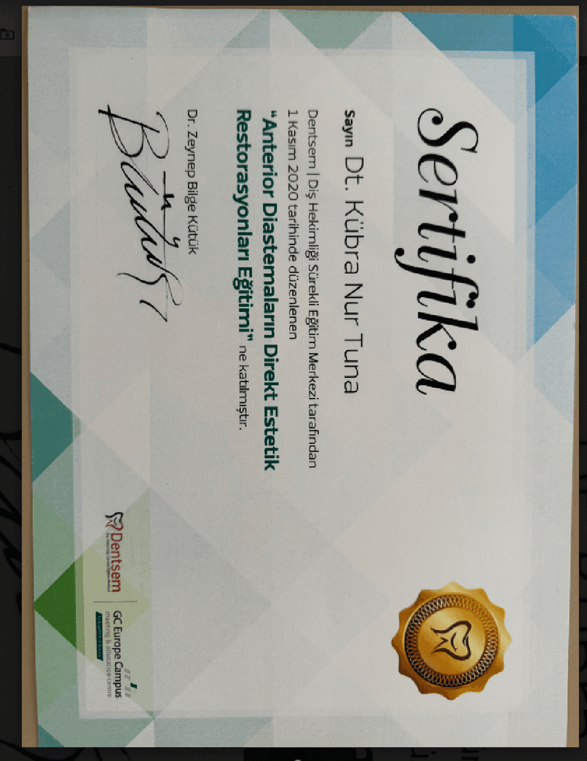 Anterior Diastemaların Direkt Estetik Restorasyonları Eğitimi