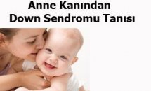 Anne kanından down sendromu