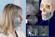 Volumetrik diş tomografisi