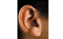 Doğumsal kulak anomalileri