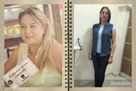 Obezitede cerrahi yöntem öncesi ve sonrası dönem