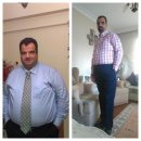 Obezite hastalığı ve beraberinde seyreden psikolojik sorunlar