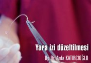 Yara izi düzeltilmesi