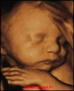 Bebeğin gelişimi ( 21 ile 30.hafta )