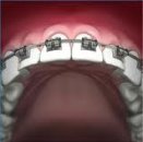 Ortodonti hakkında merak ettikleriniz
