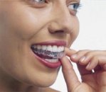 Diş gıcırdatma nedenleri ve tedavisi
