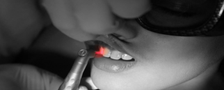 Lazer destekli diş hekimliği
