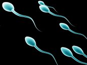 Azoospermide cerrahi yöntemlerle sperm elde etme