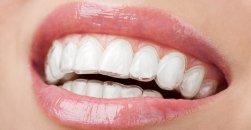 Ortodonti nedir? yetişkinlerde ve çocuklarda ortodonti