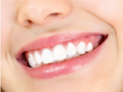 Diş beyazlatma nasıl yapılır? diş beyazlatma zararlı mıdır?