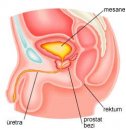 Prostat hastalıkları nelerdir?