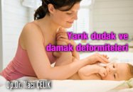 Yarık dudak ve damak deformiteleri ve tedavisi