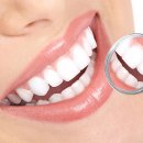 Estetik diş hekimliği uygulamaları