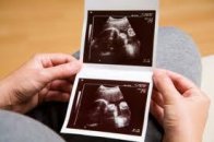 Ayrıntılı ultrason ile bebekteki tüm hastalıkları tanımak mümkün müdür?